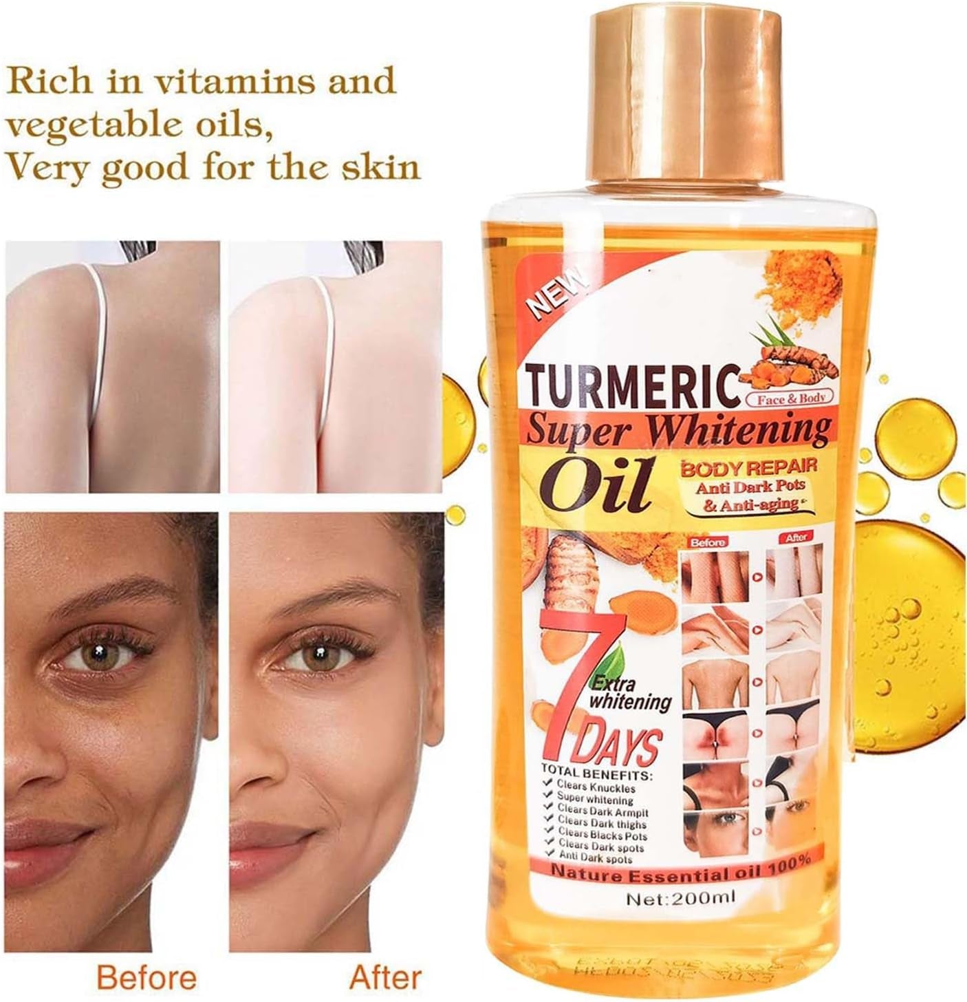 Huile Soft 7, Huile De Curcuma Soft 7, Huile Soft7, Barre De Savon Au Miel Et Au Curcuma Soft 7, Huile De Curcuma Pour La Peau, Huile Corporelle Veetgold, Huile Corporelle Au Curcuma (1PCS)