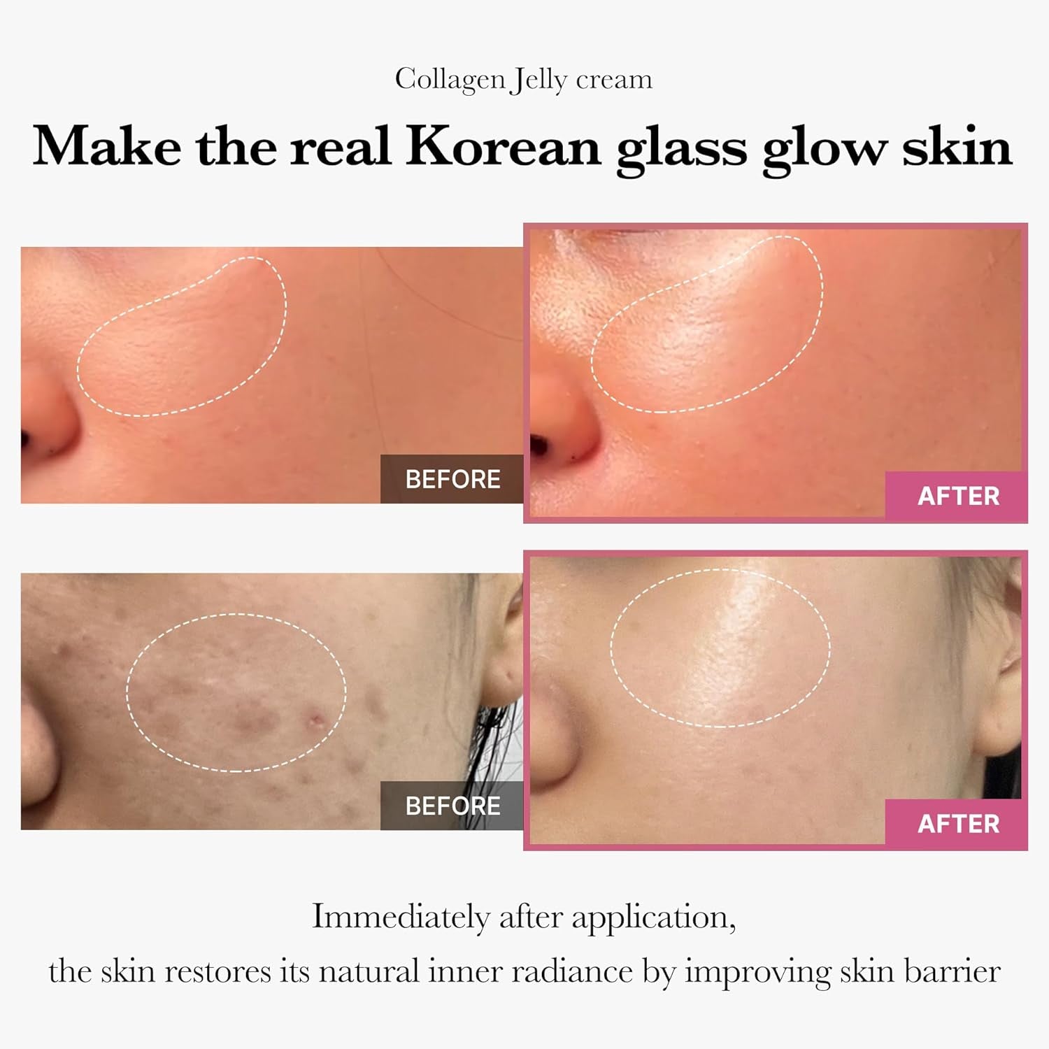 Crème À La Gelée De Collagène - Niacinamide Et Collagène Hydrolysé Lyophilisé - Augmente L'Hydratation De La Barrière De La Peau Et Donne Un Aspect Brillant Et Lifté 24H